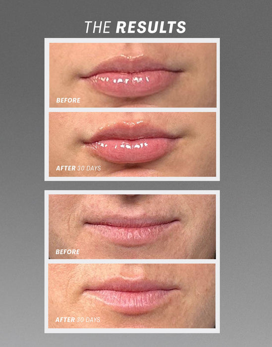 Lip Oasis Treatment